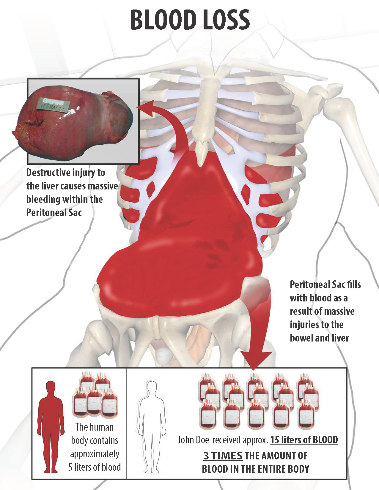 Injury Illustration_Page_3 Injury Illustration_Page_3